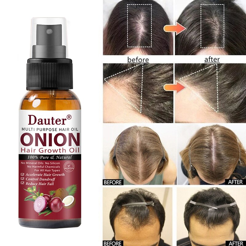 Onion black seed hair oil spray