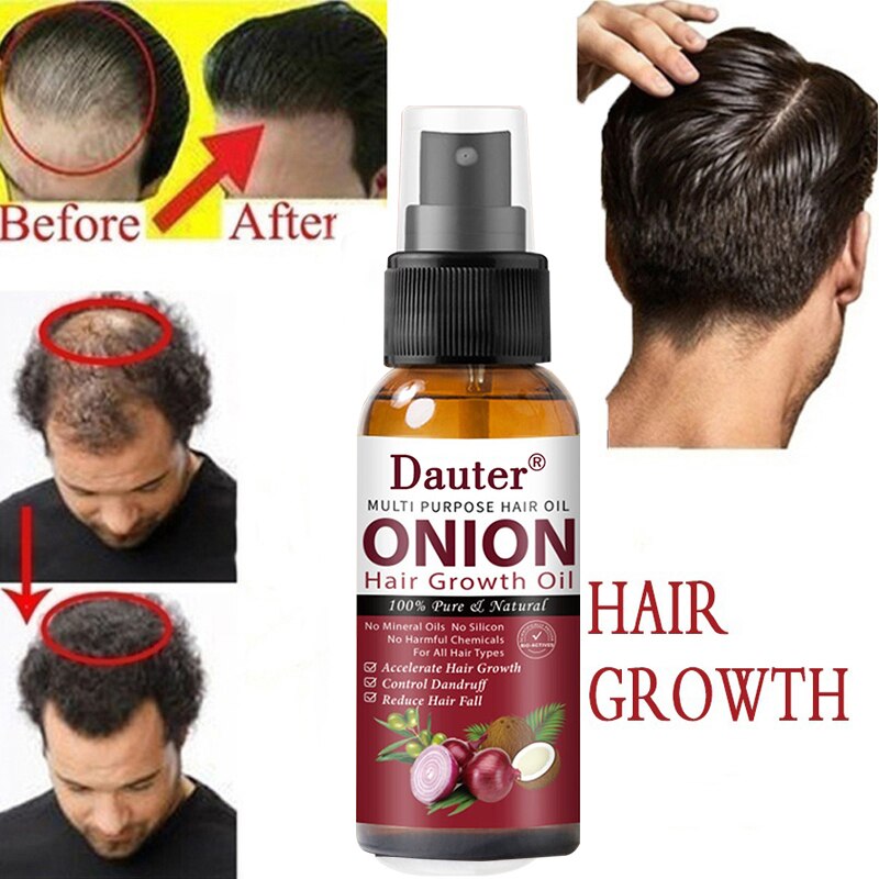 Onion black seed hair oil spray