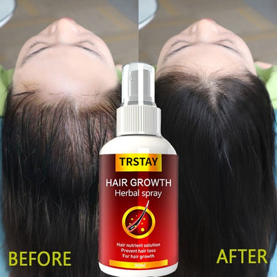 Hair Growth Serum Spray