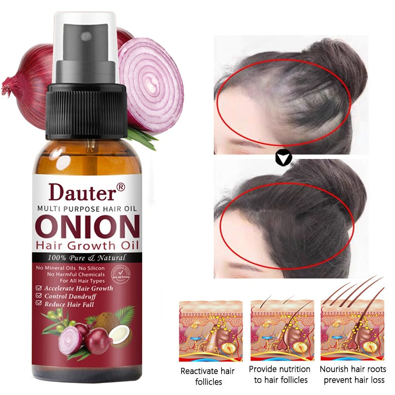 Onion black seed hair oil spray