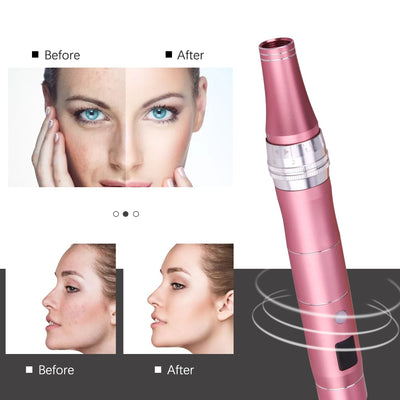 Wireless Dr Pen Ultima Dermapen